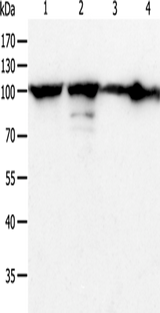 Anti-Human/Mouse/Rat HSP90B1 Antibody - ABMIUM
