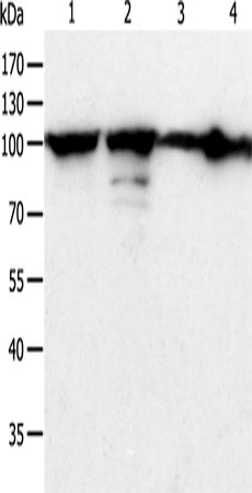 Anti-Human/Mouse/Rat HSP90B1 Antibody - ABMIUM