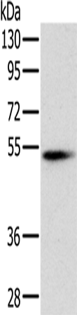Anti-Human/Mouse PNLIP Antibody - ABMIUM
