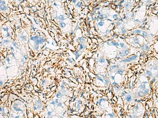 Anti-Human/Mouse/Rat ACTC1 Antibody