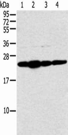Anti-Human/Mouse NDUFB9 Antibody