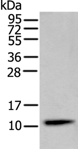 Anti-Human CST4 Antibody - ABMIUM