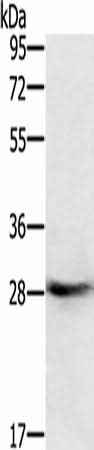 Anti-Human/Mouse/Rat RAB8B Antibody