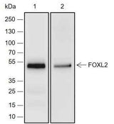 Anti-Human/Rat/Mouse FOXL2 Antibody [A225]