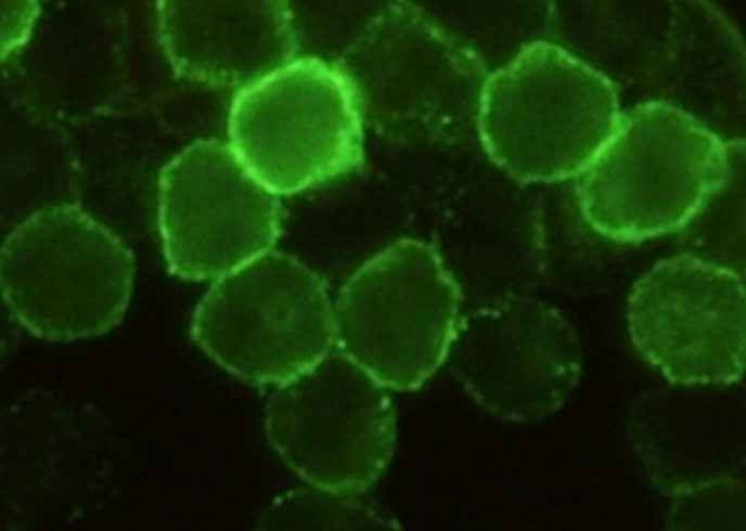 Anti-Mouse CD6 Antibody [B479] - ABMIUM