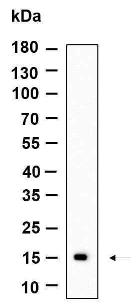 Anti-Human CLEC2B Antibody [B994] - ABMIUM