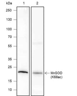 Anti-Human/Rat/Mouse SOD2 (Acetyl Lys68) Antibody [A107]