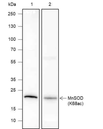 Anti-Human/Rat/Mouse SOD2 (Acetyl Lys68) Antibody [A107] - ABMIUM
