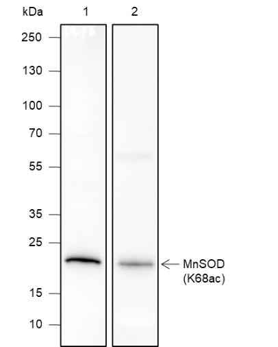 Anti-Human/Rat/Mouse SOD2 (Acetyl Lys68) Antibody [A107]