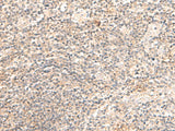 Immunohistochemistry of paraffin-embedded Human tonsil tissue using TRAPPC1 Polyclonal Antibody at dilution of 1:50(×200)