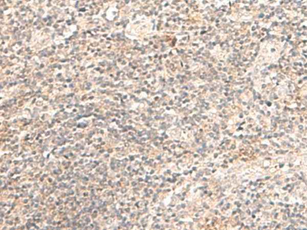 Anti-Human/Mouse/Rat TRAPPC1 Antibody