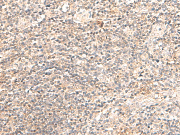 Immunohistochemistry of paraffin-embedded Human tonsil tissue using TRAPPC1 Polyclonal Antibody at dilution of 1:50(×200)