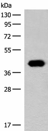 Western blot analysis of Hela cell lysate using GIPC1 Polyclonal Antibody at dilution of 1:400