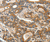 Anti-Human/Mouse ANGPTL1 Antibody - ABMIUM