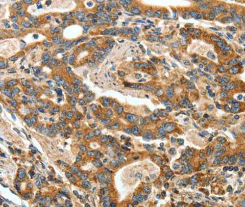 Anti-Human/Mouse ANGPTL1 Antibody