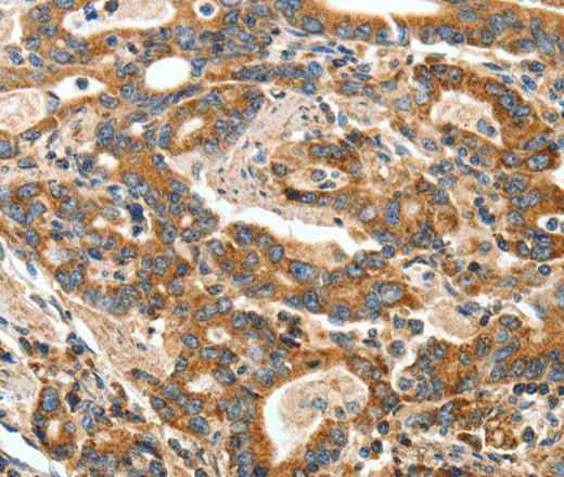 Anti-Human/Mouse ANGPTL1 Antibody