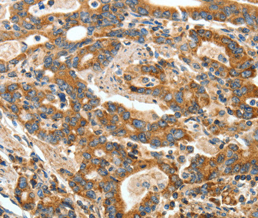 Anti-Human/Mouse ANGPTL1 Antibody - ABMIUM