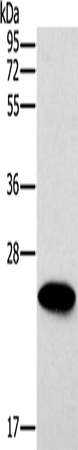 Anti-Human/Mouse ERAS Antibody - ABMIUM