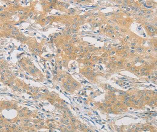 Anti-Human/Mouse/Rat HIPK4 Antibody