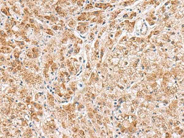 Anti-Human/Mouse/Rat HMGCLL1 Antibody