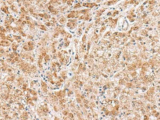 Anti-Human/Mouse/Rat HMGCLL1 Antibody