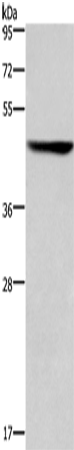 Anti-Human/Mouse/Rat CK-16 Antibody - ABMIUM