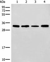 Western blot analysis of 293T and NIH/3T3 cell Mouse liver tissue lysates using ERCC1 Polyclonal Antibody at dilution of 1:600