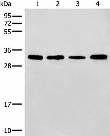 Western blot analysis of 293T and NIH/3T3 cell Mouse liver tissue lysates using ERCC1 Polyclonal Antibody at dilution of 1:600