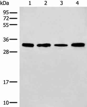 Western blot analysis of 293T and NIH/3T3 cell Mouse liver tissue lysates using ERCC1 Polyclonal Antibody at dilution of 1:600