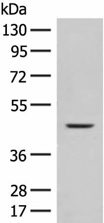 Anti-Human/Mouse FUT10 Antibody - ABMIUM