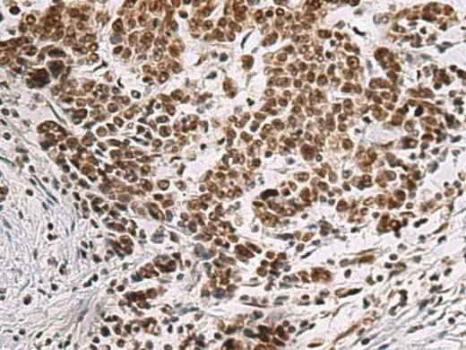 Anti-Human/Mouse/Rat CREBBP Antibody