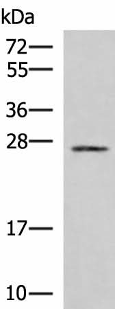 Western blot analysis of 293T cell lysate using SNRPB2 Polyclonal Antibody at dilution of 1:1000