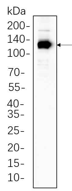 Anti-Human/Mouse/Rat eNOS Antibody [B1133] - ABMIUM