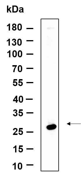 Anti-Human/Mouse/Rat NAG-2 Antibody [B974] - ABMIUM