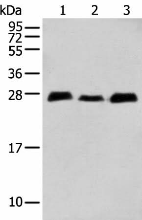 Western blot analysis of Human fetal brain tissue Human cerebrum tissue Mouse brain tissue using MOB4 Polyclonal Antibody at dilution of 1:400