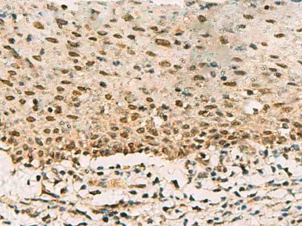 Anti-Human/Mouse/Rat PHF5A Antibody