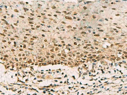 Anti-Human/Mouse/Rat PHF5A Antibody