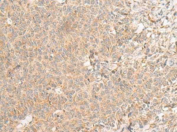 Anti-Human RNF207 Antibody