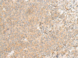 Anti-Human RNF207 Antibody - ABMIUM