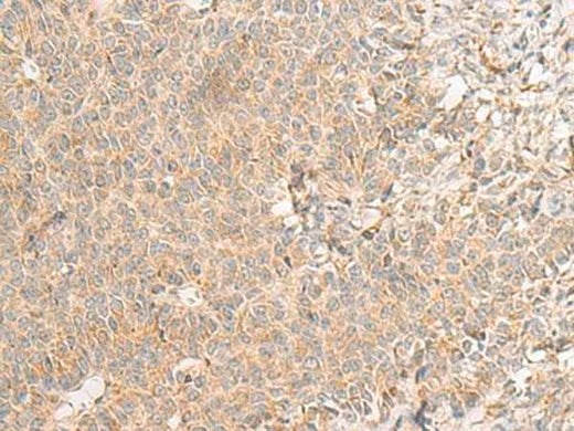 Anti-Human RNF207 Antibody