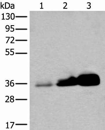 Anti-Human/Mouse/Rat UBE2Z Antibody