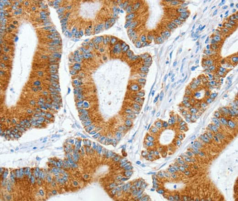 Anti-Human/Mouse/Rat MANF Antibody - ABMIUM