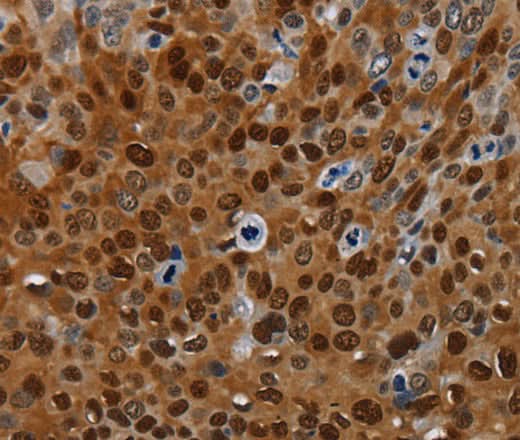 Anti-Human/Mouse/Rat NRP2 Antibody - ABMIUM