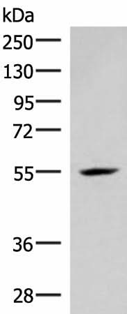 Western blot analysis of Mouse heart tissue lysate using IRX4 Polyclonal Antibody at dilution of 1:400