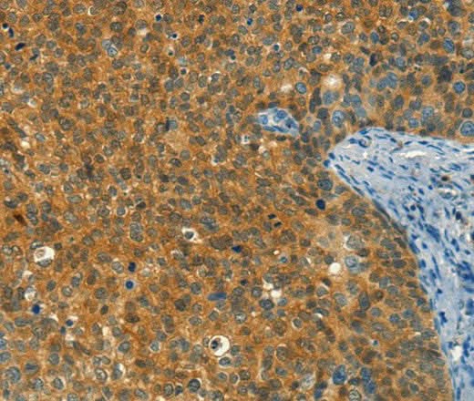 Anti-Human DIRAS1 Antibody - ABMIUM