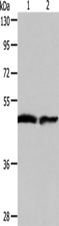 Anti-Human AADAC Antibody - ABMIUM