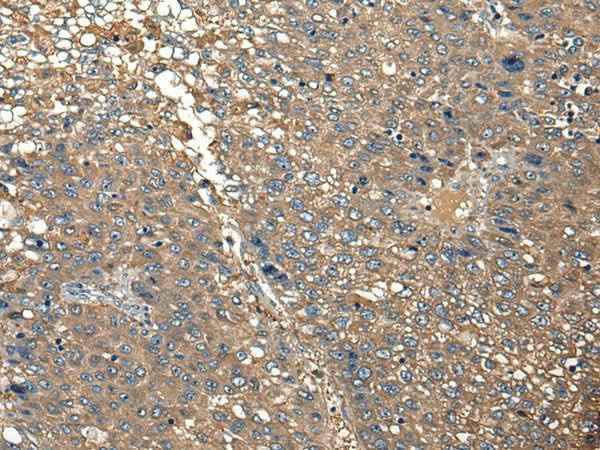 Anti-Human DGKI Antibody