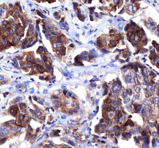 Anti-Human HER4/ErbB4 Antibody [A584] - ABMIUM