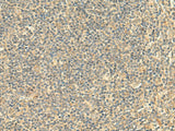 Immunohistochemistry of paraffin-embedded Human tonsil tissue using NTAN1 Polyclonal Antibody at dilution of 1:50(×200)