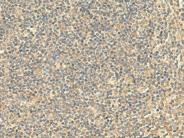 Immunohistochemistry of paraffin-embedded Human tonsil tissue using NTAN1 Polyclonal Antibody at dilution of 1:50(×200)